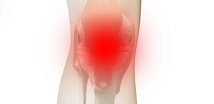 膝の痛みの原因とは？？